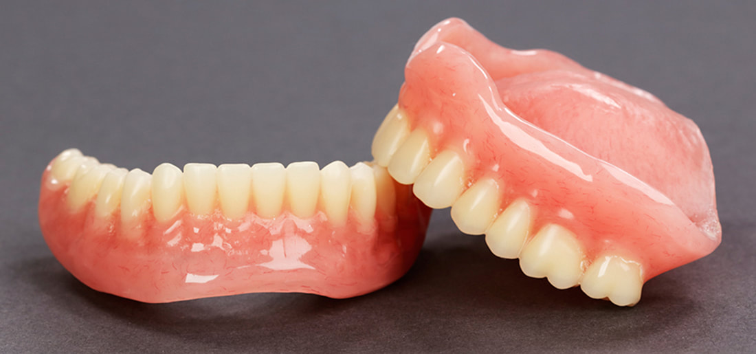 Dentures a good replacement for patient's missing teeth
