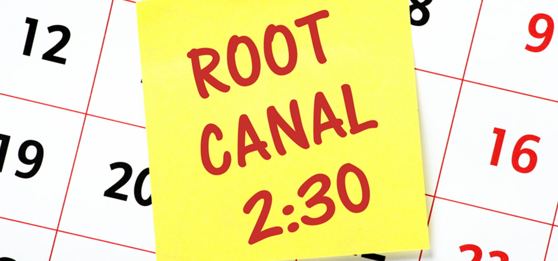 Root canal calendar schedule.